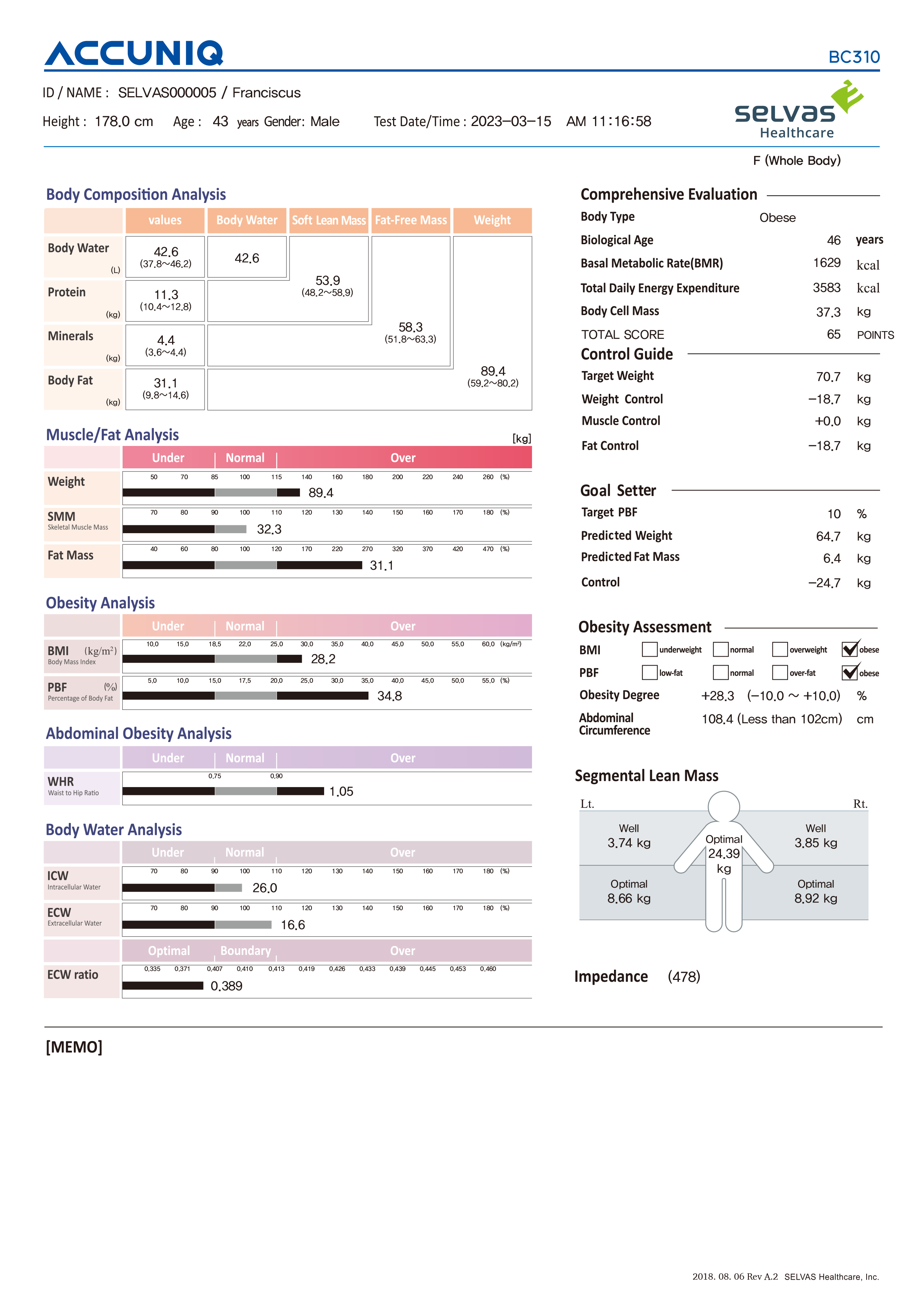 ACCUNIQ BC310 with Built-in Thermal Printer