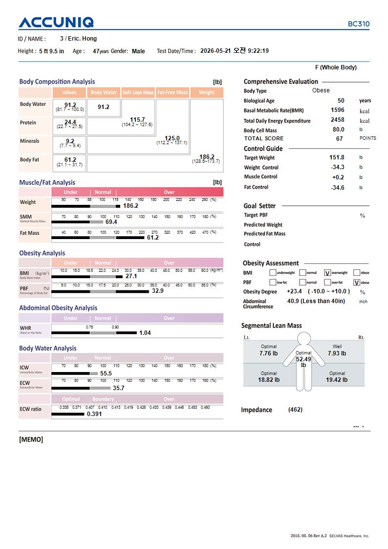 ACCUNIQ BC310 with Built-in Thermal Printer